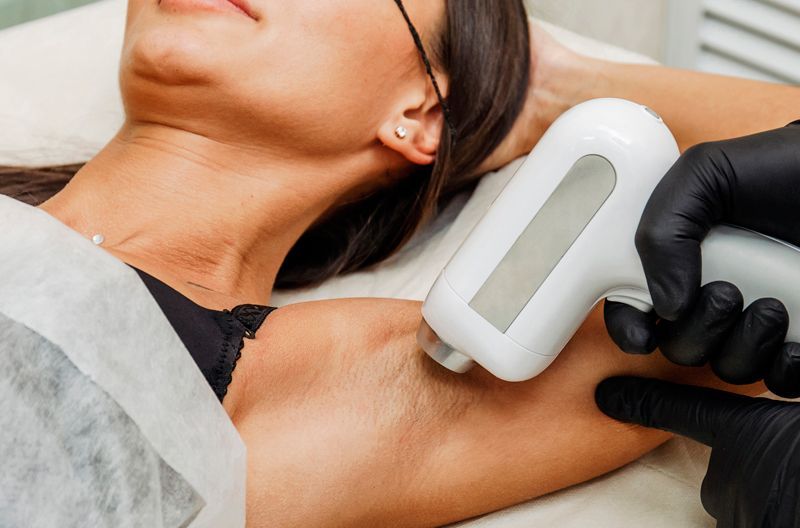 depilacion-axilas-laser
