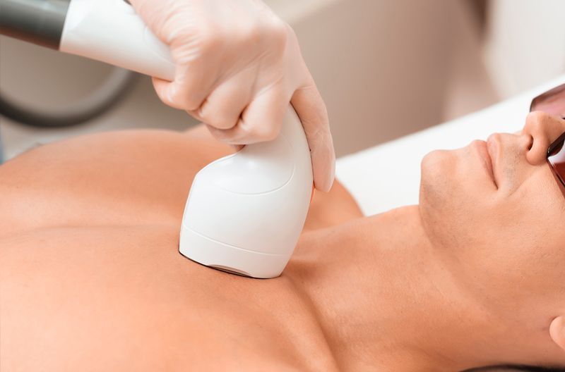 depilacion-pecho-hombre-mairena-del-alcor