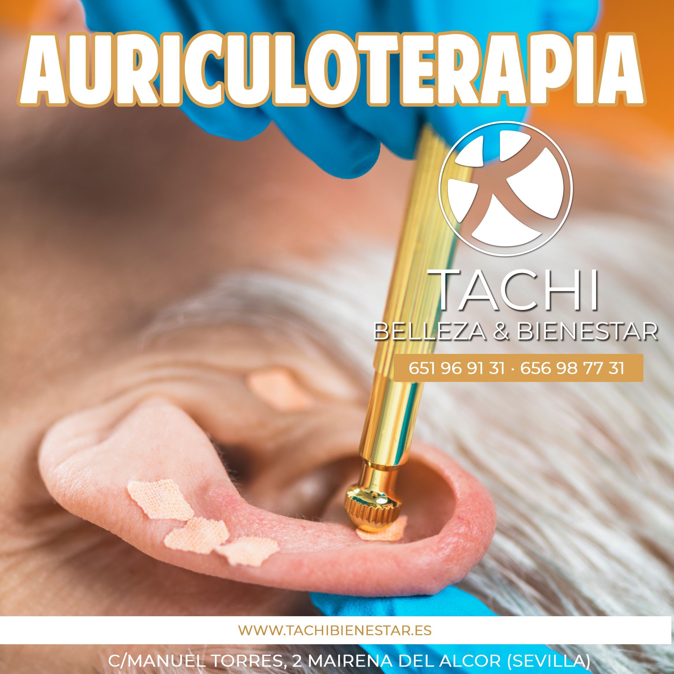 Auriculoterapia en Sevilla